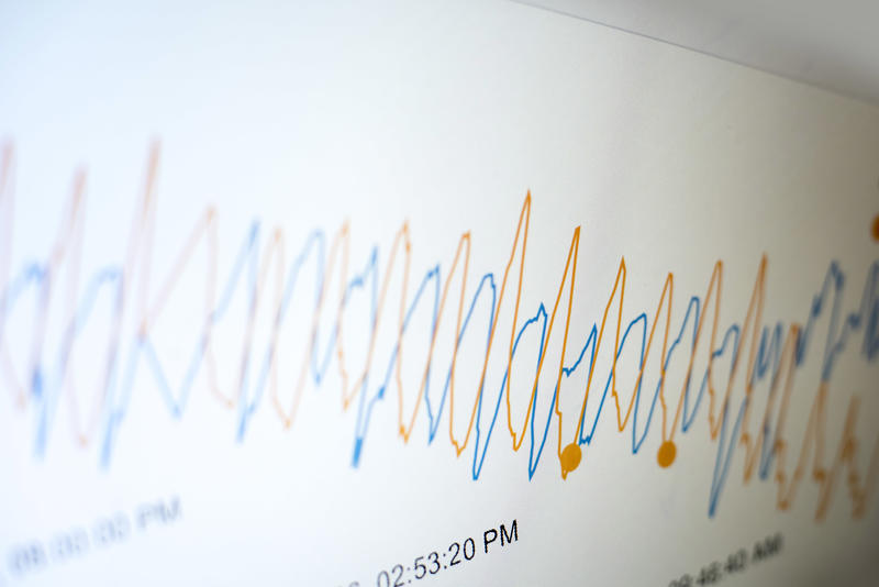 Temperature monitor graphs oscillogram of blue and yellow curves on white background, selective focus close-up image